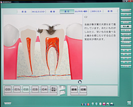 NEO DENTAL i3